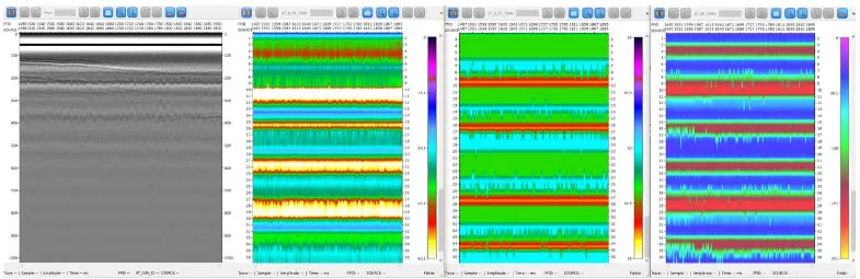 Source QC displays: near-field hydrophone stack, bubble peak amplitude, time and period maps